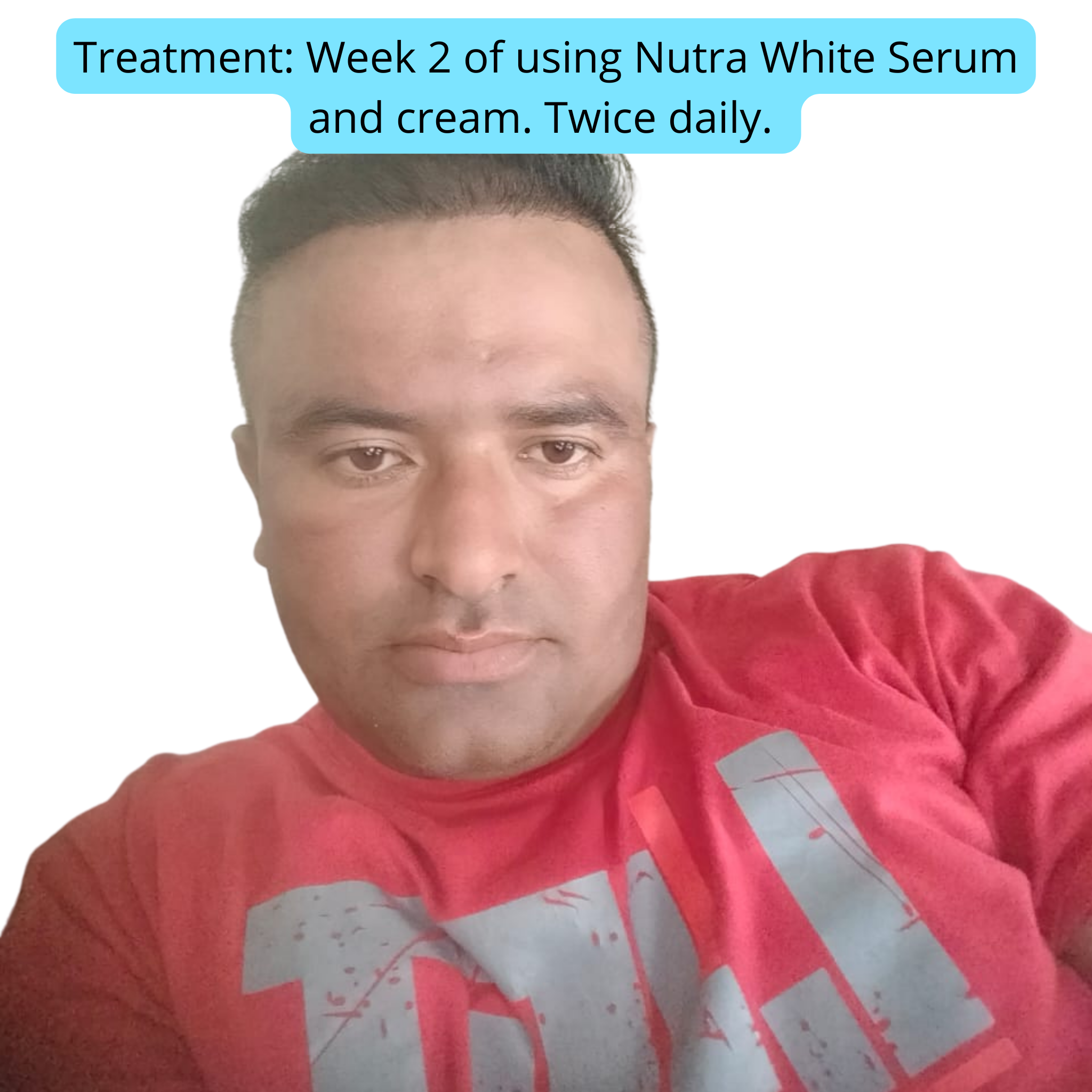 Nutra White Glutathione Whitening Serum - Nutrex Labs