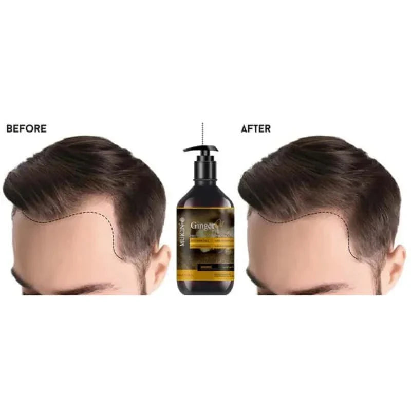 Ginger Oil Anti-Hair Fall Shampoo - Muicin