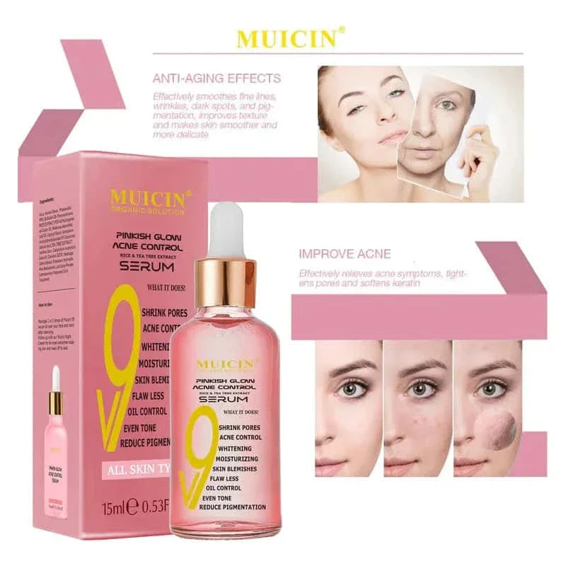 V9 Pinkish Glow Anti Acne Face Serum - Muicin