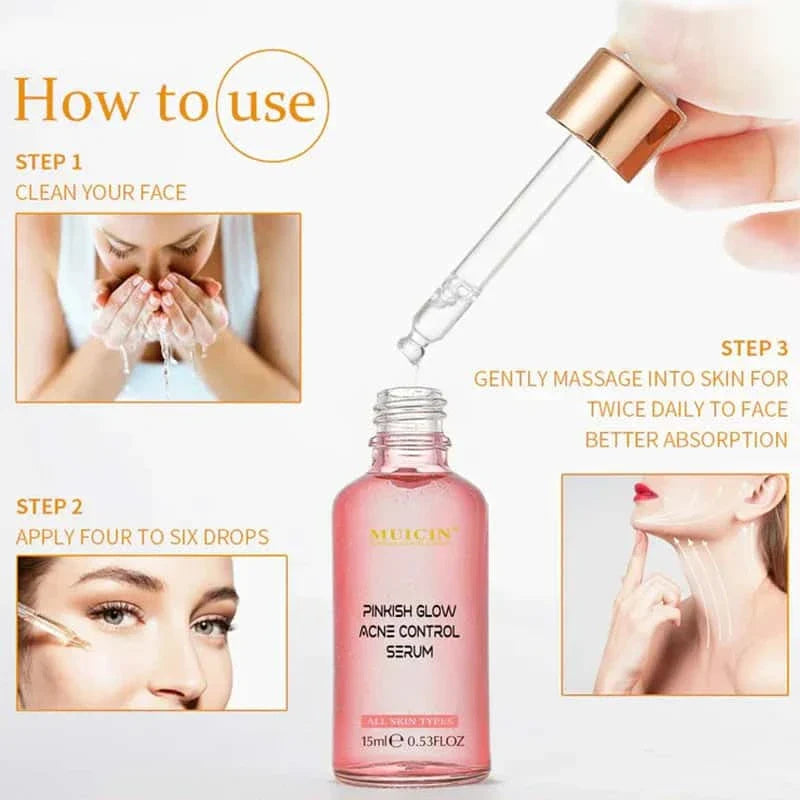 V9 Pinkish Glow Anti Acne Face Serum - Muicin