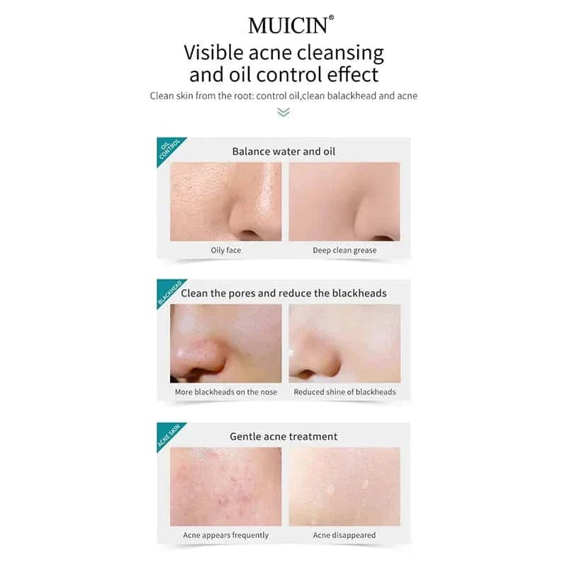 Tea Tree Bubble Foaming Facial Cleanser - Muicin