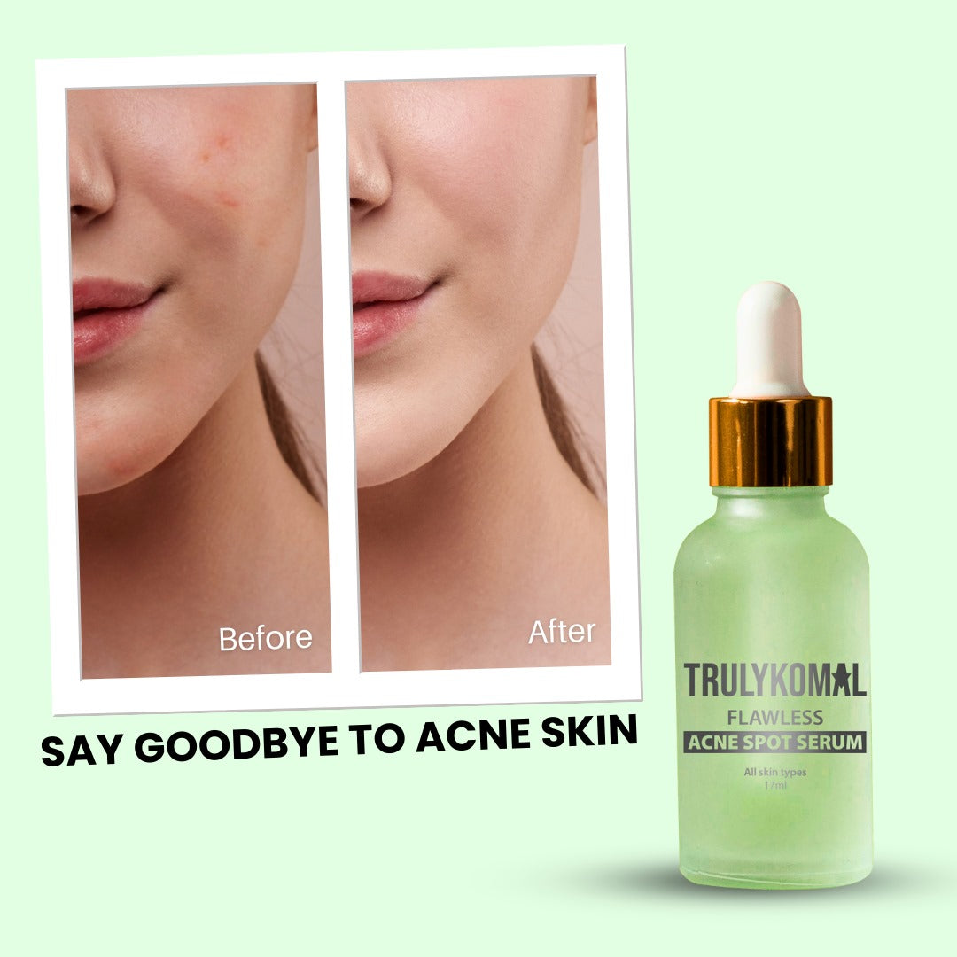 Flawless Acne Spot Serum - TrulyKomal