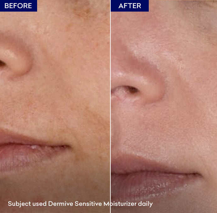 Dermive Sensitive Moisturizer 100ml - Jenpharm
