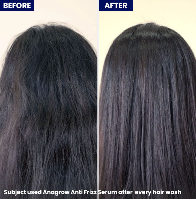 Anagrow Anti Frizz Hair Serum 50ml - Jenpharm