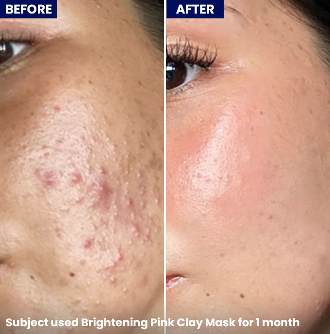 Brightening Pink Clay Mask 40g - Jenpharm