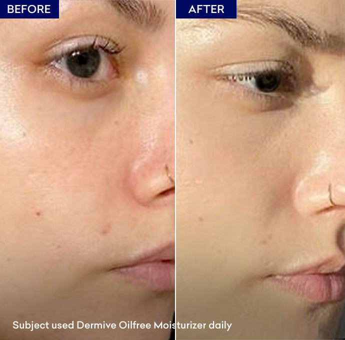 Dermive Oil Free Moisturizer 100ml - Jenpharm