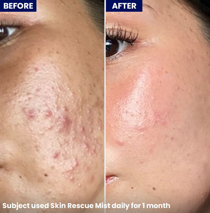 Skin Rescue Mist 100ml - Jenpharm