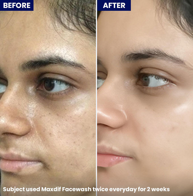 Maxdif Facewash 100ml - Jenpharm