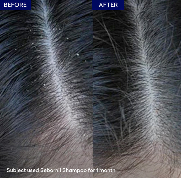 Sebornil Shampoo 100ml - Jenpharm